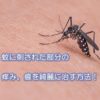 蚊に刺された部分の痒み、痕を綺麗に治す方法！