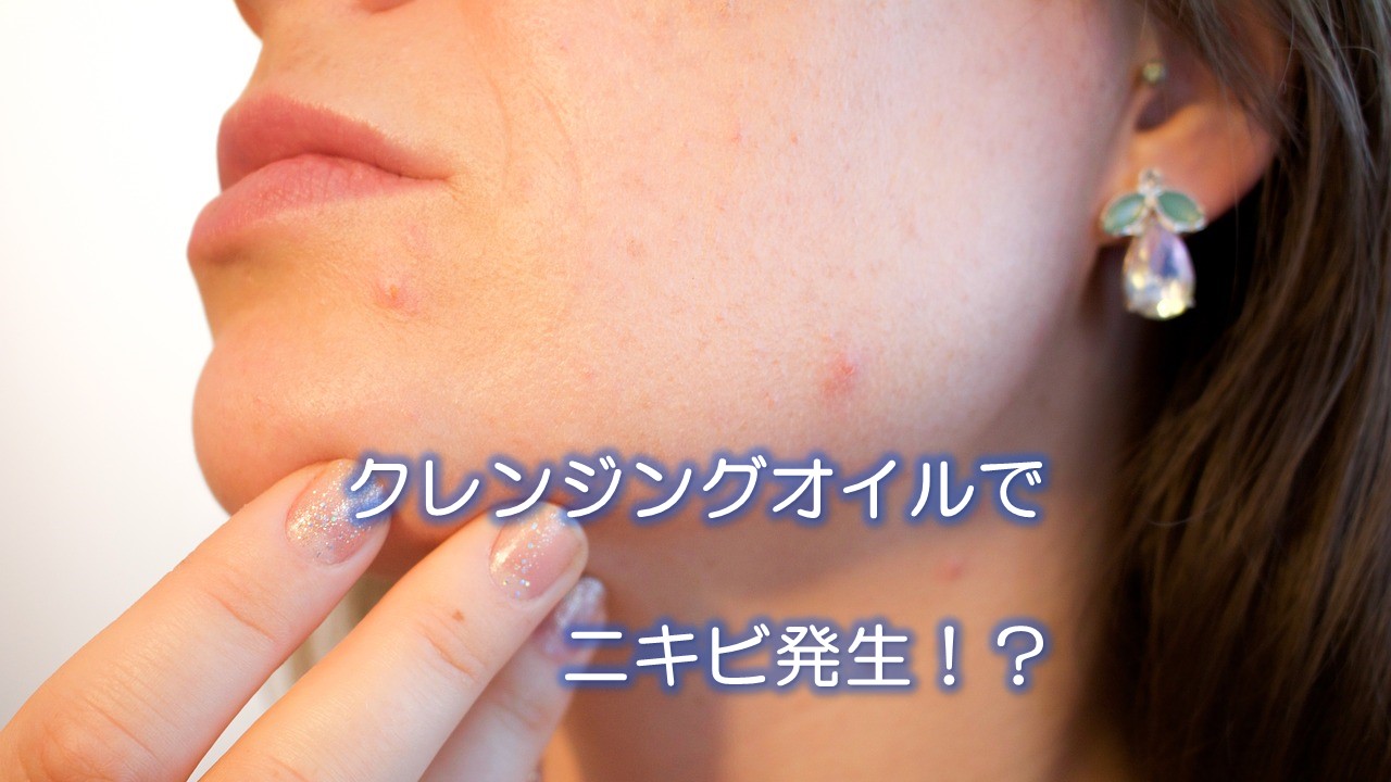 クレンジングオイルでニキビ発生!?